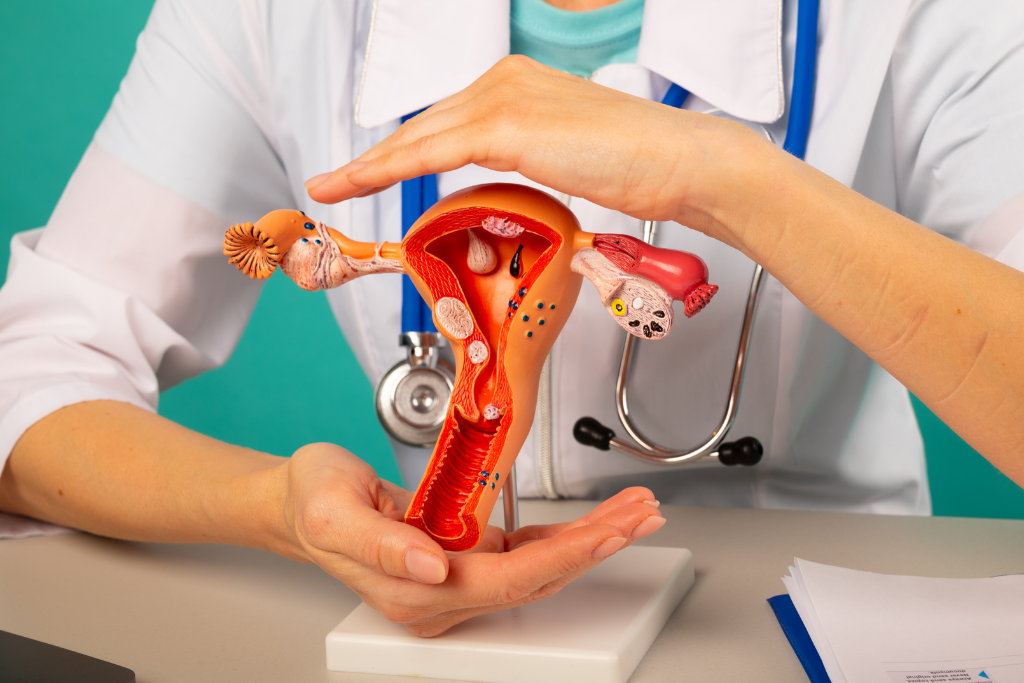 What Are the First Signs of PCOS? A Comprehensive Guide